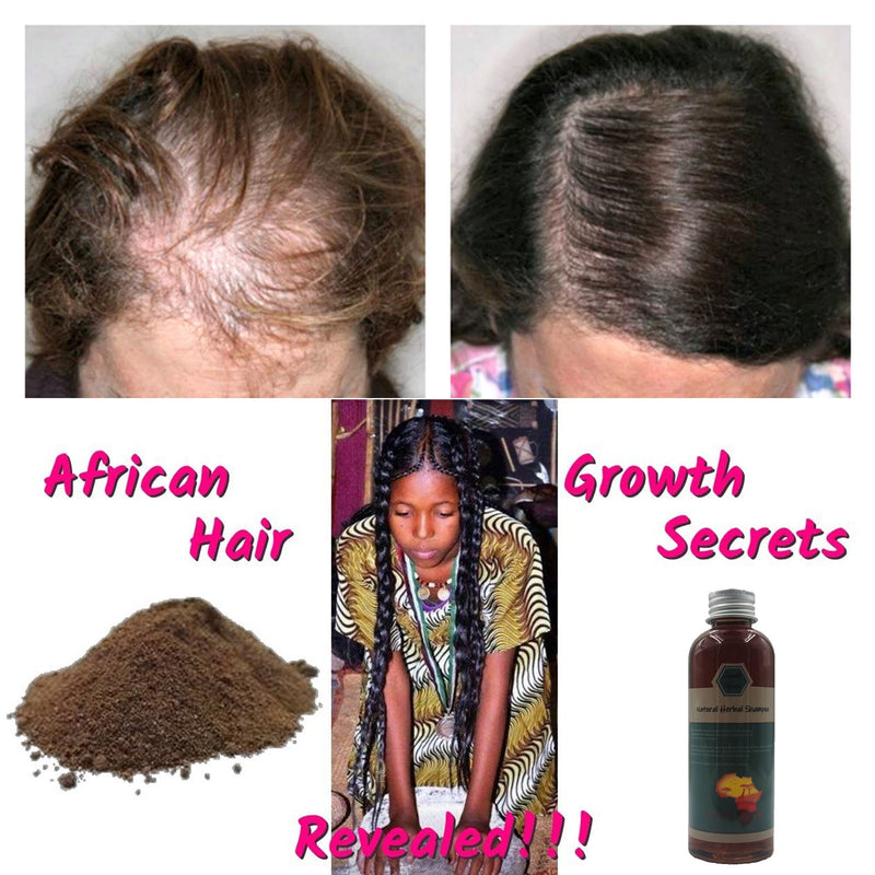 Africa Wild Rosemary Oil Crazy Hair Growth Traction Alopecia Chebe Powder Hair Loss Regrow your Edges Bald Spots Thinnin Hair