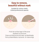 Blackhead Acne Set Beauty Needle Acne Needle Pimple Pin Stainless Steel Four-Piece Set Pimple Needle Acne Removal Tools
