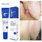 Scar Removal Cream Gel Remove Acne Spots Treatment Stretch Marks Burn Surgical Scar Repair Cream Smoothing Whitening Skin Beauty