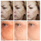 Freckle Removal Cream Whitening Cream Remove Dark Spots Melanin Melasma Pigmentation Anti-Aging Brighten Face Skin Care Cosmetic