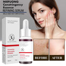 NIEFUONG Face Serum Replenishment Moisturize Shrink Pore Brighten Skin Care Firming Facial Essence