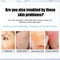 Nicotinamide Whitening Freckle Cream Dark Spot Remover Skin Care Products Moisturizing Brighten Pigment Correction Face Beauty