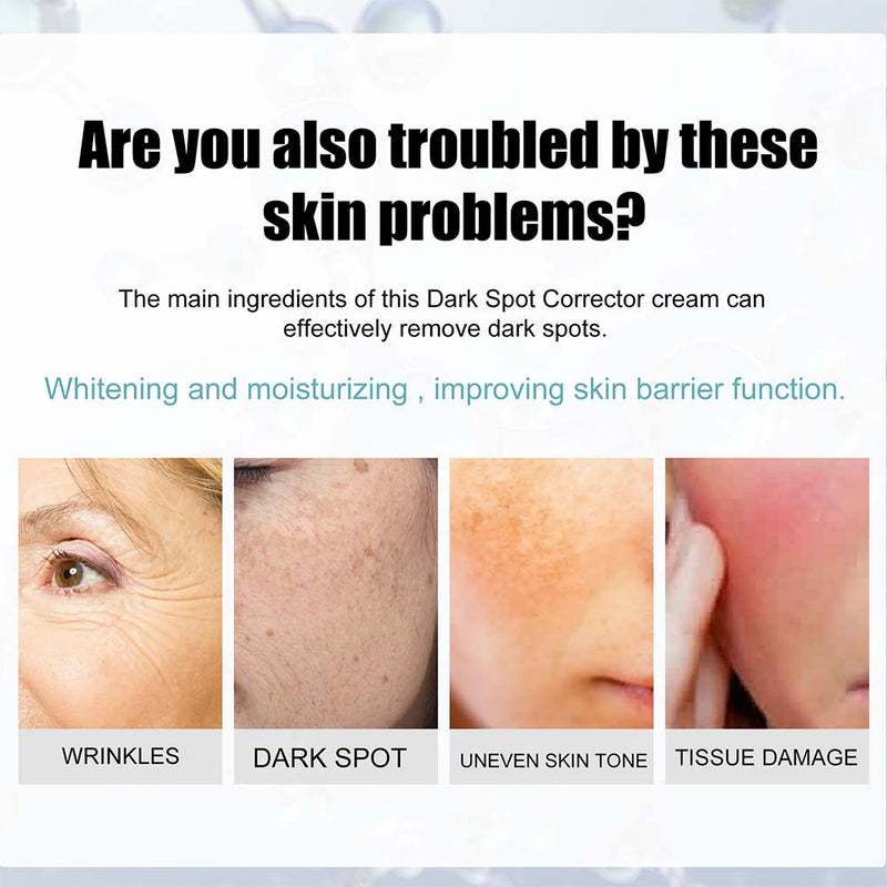 Nicotinamide Whitening Freckle Cream Dark Spot Remover Skin Care Products Moisturizing Brighten Pigment Correction Face Beauty
