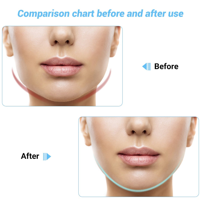 EMS Facial Lifting Device Double Chin V Shape Lift Belt Red Blue Light LED Face Slimming Vibration Face Massager Anti Cellulite