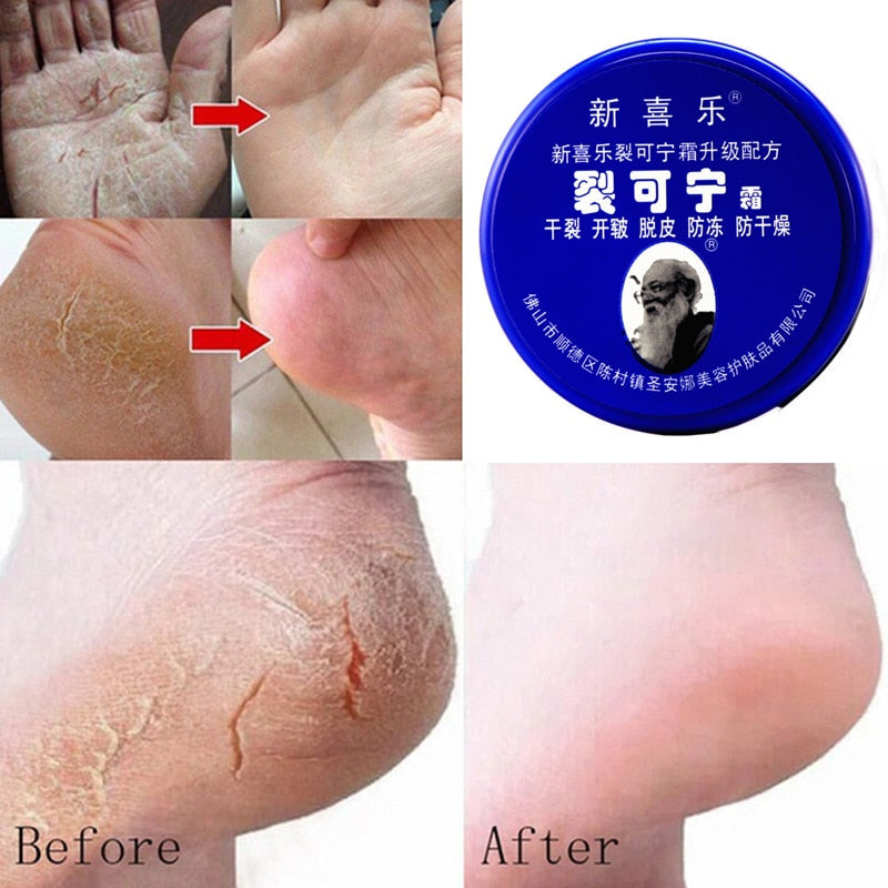 Herbal Anti Crack Foot Cream Anti-Drying Anti-Freeze Crack Feet Mask Heel Cracked Repair Products Removal Hand Feet Dead Skin