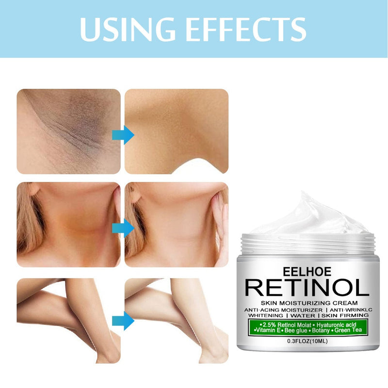 Women Body Whitening Cream Underarm Legs Knee Elbow Private Parts Brighten Armpit Whitening Cream Remove Dark Spots Skin Care