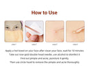 Blackhead Acne Set Beauty Needle Acne Needle Pimple Pin Stainless Steel Four-Piece Set Pimple Needle Acne Removal Tools