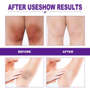 Intimate Area Pink Essence Body Whitening Cream Underarm Knee Butt Dullness Brighten Improve Lip Moisturizer Facial Beauty Care