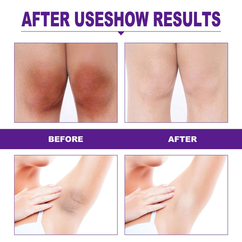 Intimate Area Pink Essence Body Whitening Cream Underarm Knee Butt Dullness Brighten Improve Lip Moisturizer Facial Beauty Care