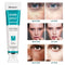 Whitening Freckle Cream Remove Melasma Cream Remove Dark Spots Melanin Melasma Remover Brighten Skin Anti-Aging Skin Lightening
