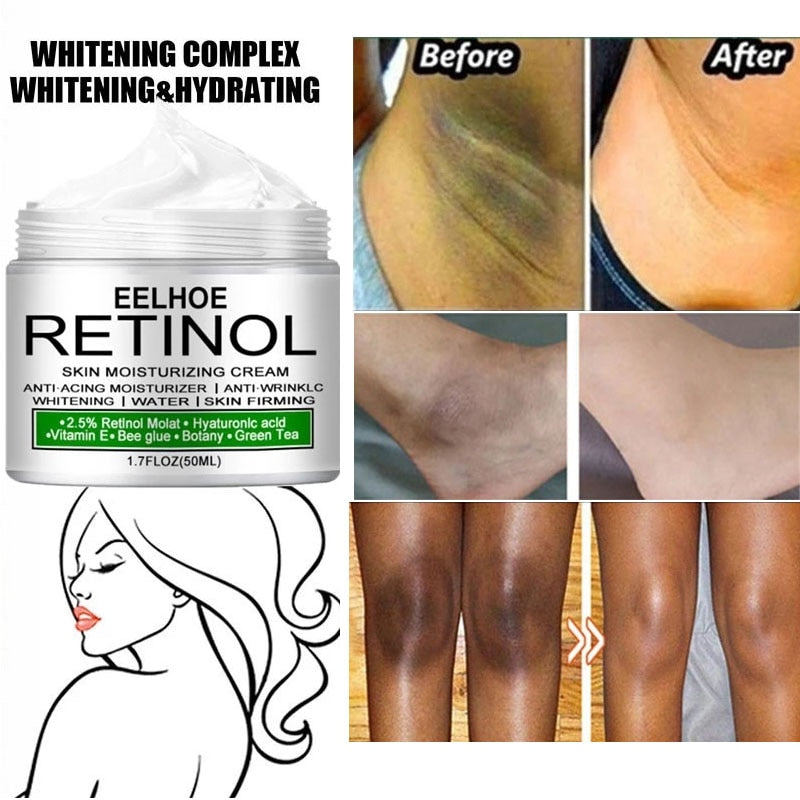 Body Whitening Cream Underarm Knee Buttocks Dark Skin Bleach Improve Melanin Pigmentation Dull Moisturizing Brighten Skin Care