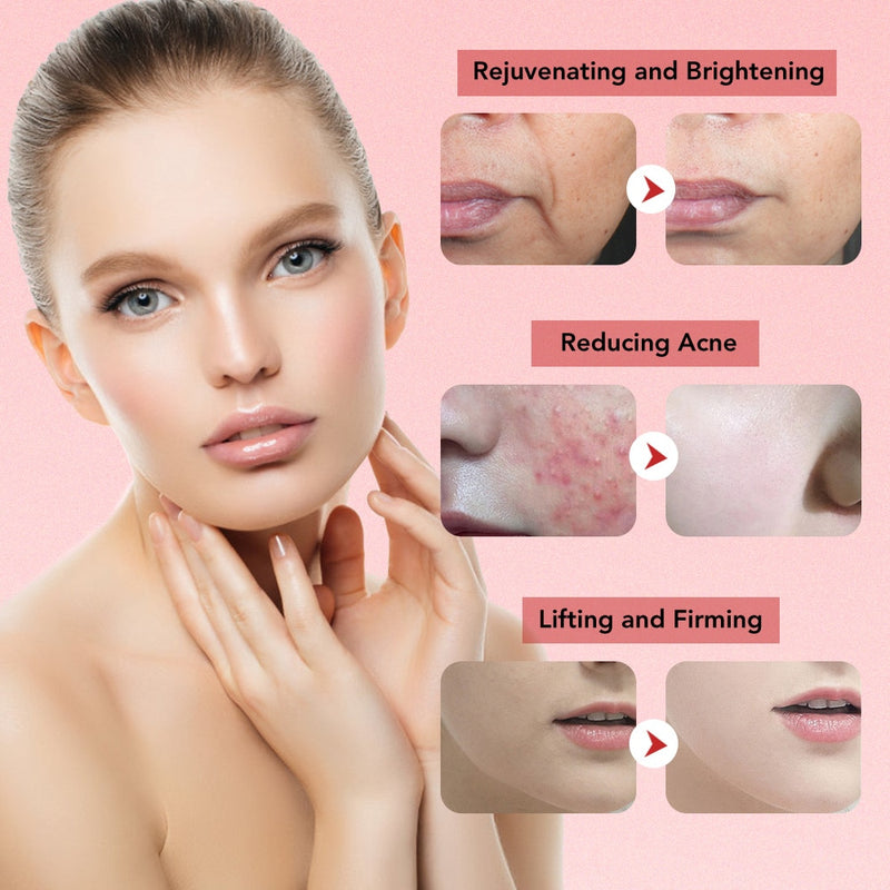 7 in 1 Face Lift Devices EMS RF Microcurrent Skin Rejuvenation Facial Massager Light Therapy Anti Aging Wrinkle Beauty Apparatus