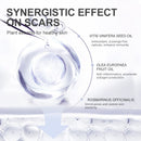 Skin Scar Removal Cream Face Fade Scars Cream Acne Spots Acne Treatment Blackhead Whitening Cream Anti Scar Stretch Marks Beauty