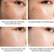 Powerful Whitening Freckle Cream Remove  Acne Spots Melanin Dark Spots Face Lift Firming Face Skin Care Beauty Essentials