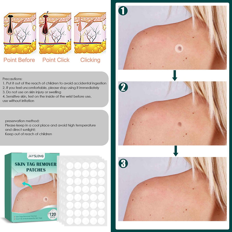 120-480pcs Skin Tag Remover Patch Wart Treatment Stickers Absorb Plaster Hydrocolloid Gel Anti-infection Invisible Skin Care