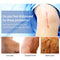 Scar Removal Cream Gel Remove Acne Spots Treatment Stretch Marks Burn Surgical Scar Repair Cream Smoothing Whitening Skin Beauty