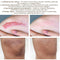 Acne Surgical Stretch Marks Removal Scar Cream Pimples Face Gel Child Acne Smoothening Whitening Body Skin Care Pigmentation