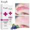 Skin Scar Removal Cream Face Fade Scars Cream Acne Spots Acne Treatment Blackhead Whitening Cream Anti Scar Stretch Marks Beauty