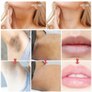 Intimate Area Pink Essence Body Whitening Cream Underarm Knee Butt Dullness Brighten Improve Lip Moisturizer Facial Beauty Care