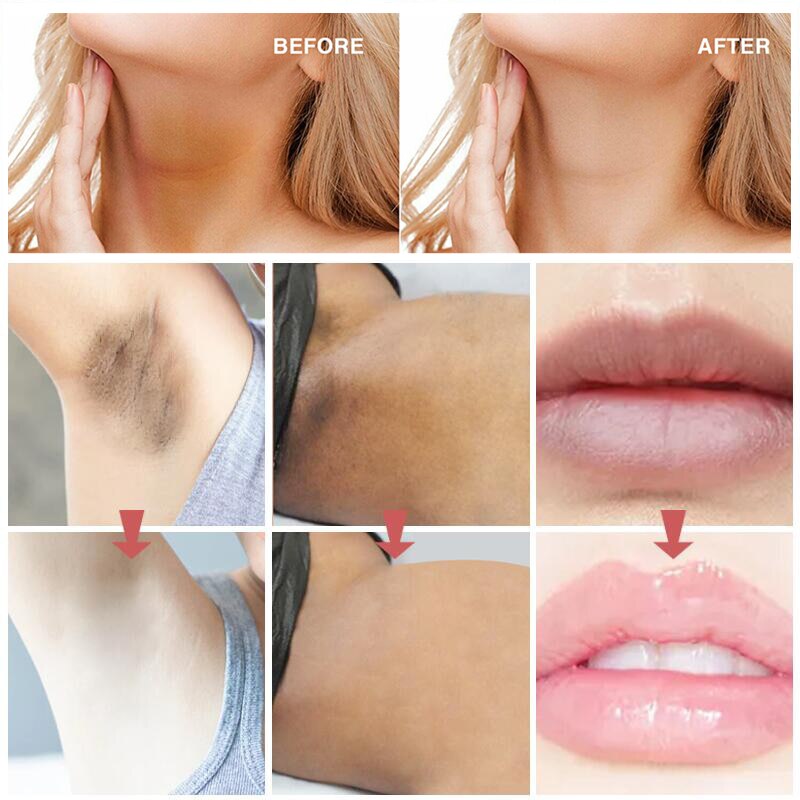 Intimate Area Pink Essence Body Whitening Cream Underarm Knee Butt Dullness Brighten Improve Lip Moisturizer Facial Beauty Care