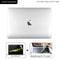 For Macbook Pro 13 Case M2 2022 2020 Air M1 For MacBook Air 13 Case Cover Funda Pro 16 Case 2021 Pro 14 Case 15 New Laptop Case