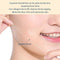 5Bags/60Pcs Protein Thread No Needle Gold Protein Line Absorbable Anti-wrinkle Face Filler Women Beauty Care Skin Collagen Based