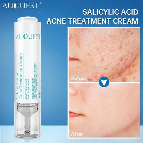 AUQUEST Salicylic Acid Acne Face Cream Skin Care Hyaluronic Acid Black Dots Acne Pimple Remove Treatment Cream Beauty Health