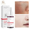 NIEFUONG Face Serum Replenishment Moisturize Shrink Pore Brighten Skin Care Firming Facial Essence