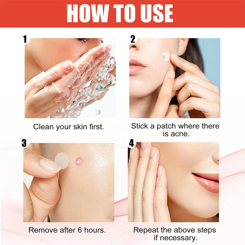 144pcs/set Face Men Women Skin Care Acne Pimple Patch 2 Sizes Invisible Professional Healing Absorbing Spot Sticker Covering