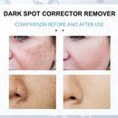 Nicotinamide Whitening Freckle Cream Dark Spot Remover Skin Care Products Moisturizing Brighten Pigment Correction Face Beauty