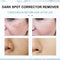 Nicotinamide Whitening Freckle Cream Dark Spot Remover Skin Care Products Moisturizing Brighten Pigment Correction Face Beauty