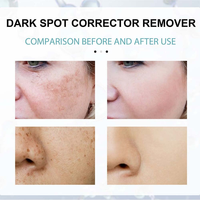 Nicotinamide Whitening Freckle Cream Dark Spot Remover Skin Care Products Moisturizing Brighten Pigment Correction Face Beauty