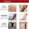 Effective Herbal Varicose Veins Relief Cream Vasculitis Phlebitis Spider Pain Relief Ointment Herb Plaster Beauty Body Care 20g
