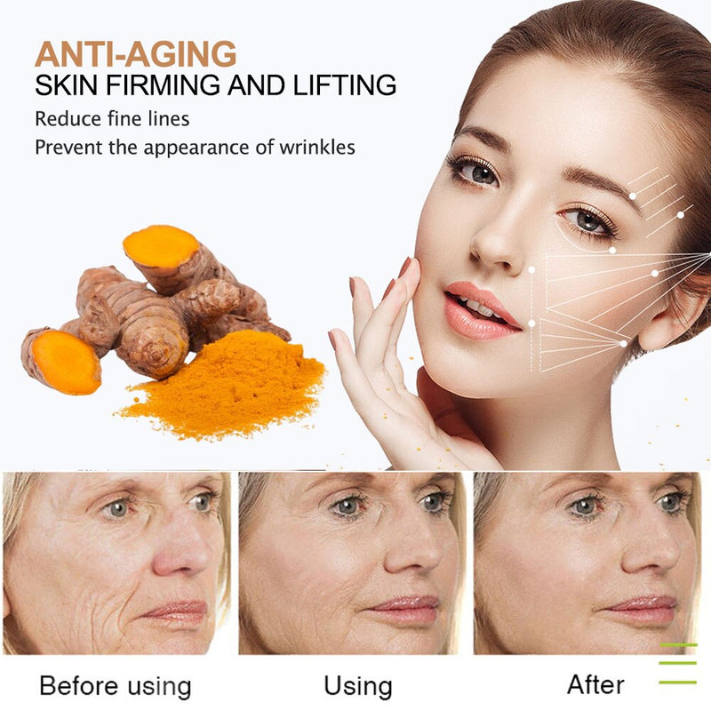 30ml Turmeric Serum Skin Glow To Lightening Acne Dark Patches, Acne Bright Dark Spot Corrector Face Whitening Serum Skin Care