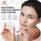 Powerful Whitening Freckle Cream Remove  Acne Spots Melanin Dark Spots Face Lift Firming Face Skin Care Beauty Essentials