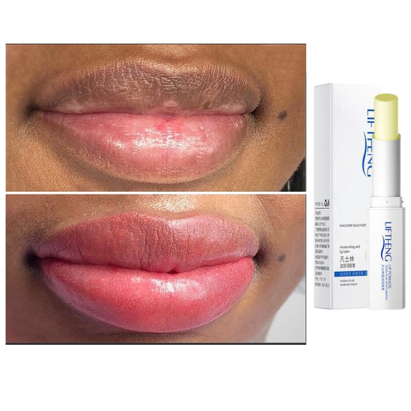 Pure Natural Herbal Medicine Lip Black Removal Lip Balm Eliminate Uneven Darkness on Lips Treatment Fast Results Lip Care
