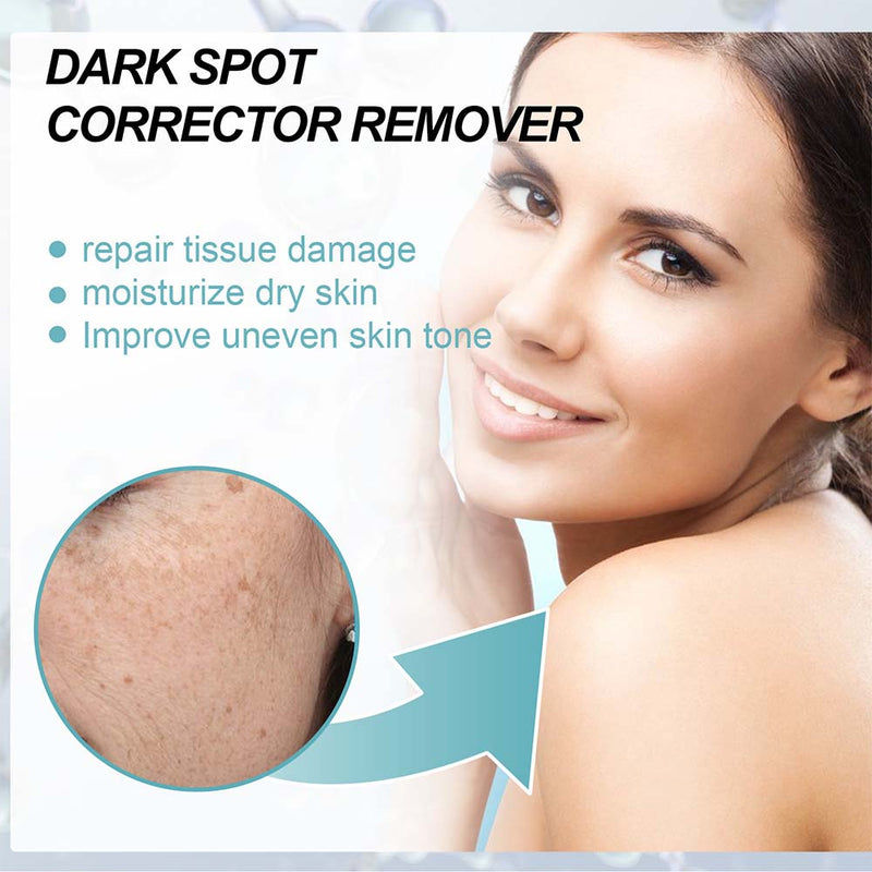 Nicotinamide Whitening Freckle Cream Dark Spot Remover Skin Care Products Moisturizing Brighten Pigment Correction Face Beauty