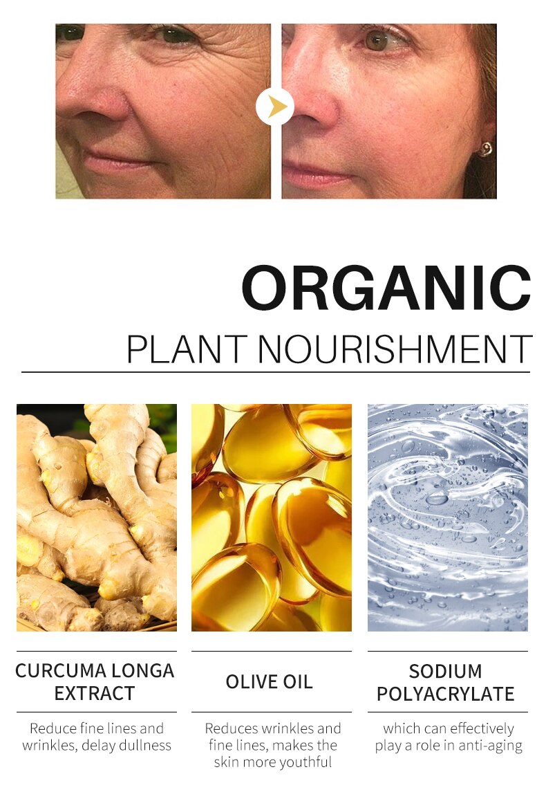 30ml Turmeric Serum Skin Glow To Lightening Acne Dark Patches, Acne Bright Dark Spot Corrector Face Whitening Serum Skin Care