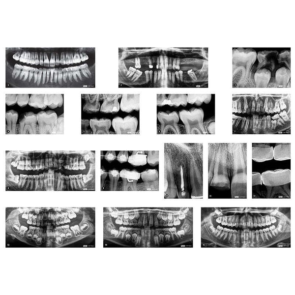 DENTAL XRAYS-Arts & Crafts-JadeMoghul Inc.