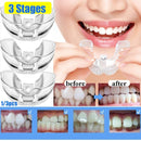 Dental Orthodontic Teeth Corrector Silicone Braces Retainer Straighten Tools Teeth Capped for Adults Tooth Care Tools 3 Phases