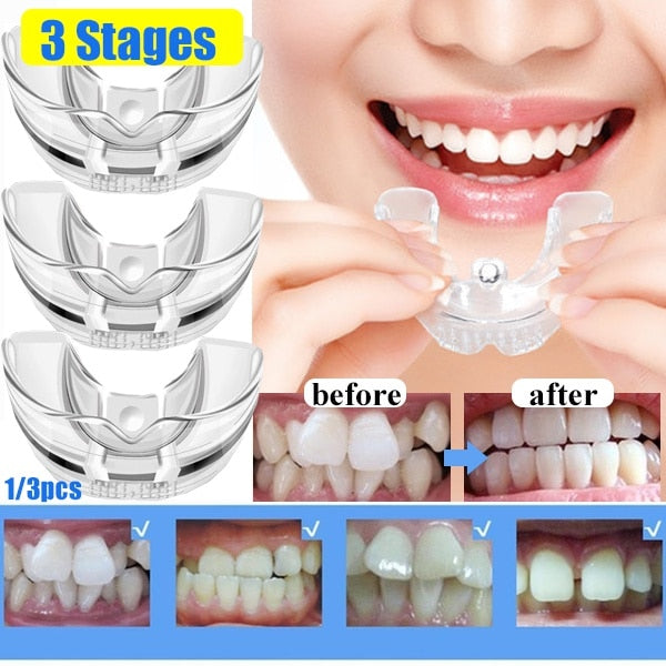 Dental Orthodontic Teeth Corrector Silicone Braces Retainer Straighten Tools Teeth Capped for Adults Tooth Care Tools 3 Phases